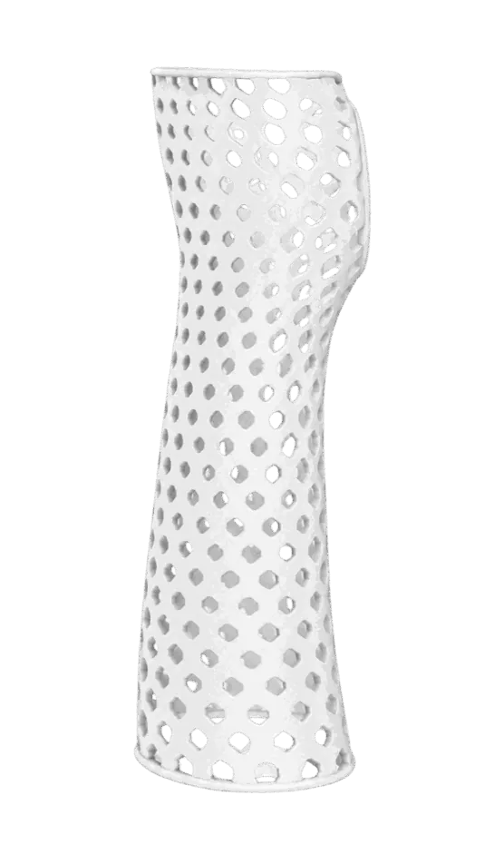 Upper Limb Orthoses — 3D printed orthopedic device